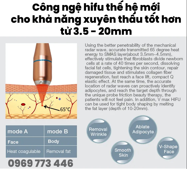 /cong-nghe-hifu-vmax