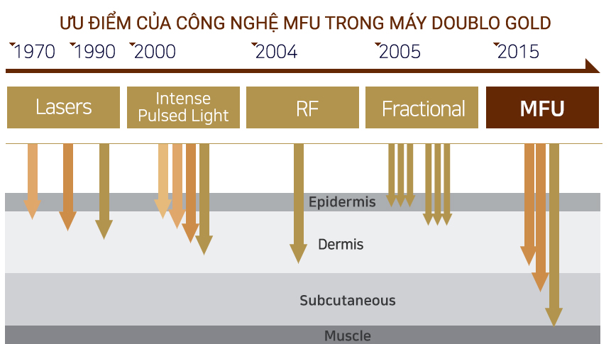 cong-nghe-mfu-hifu