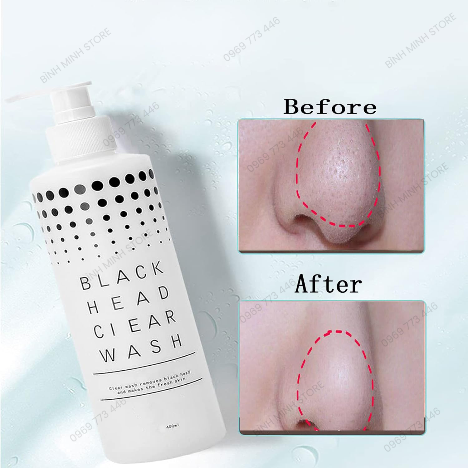 hieu-qua-truoc-va-sau-khi-su-dung-san-pham