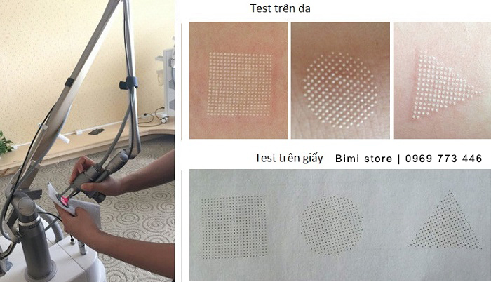 may-laser-co2-ve-hinh