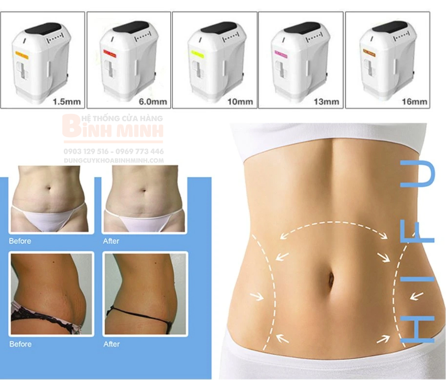 may-nang-co-hifu-3d-thon-gon-body