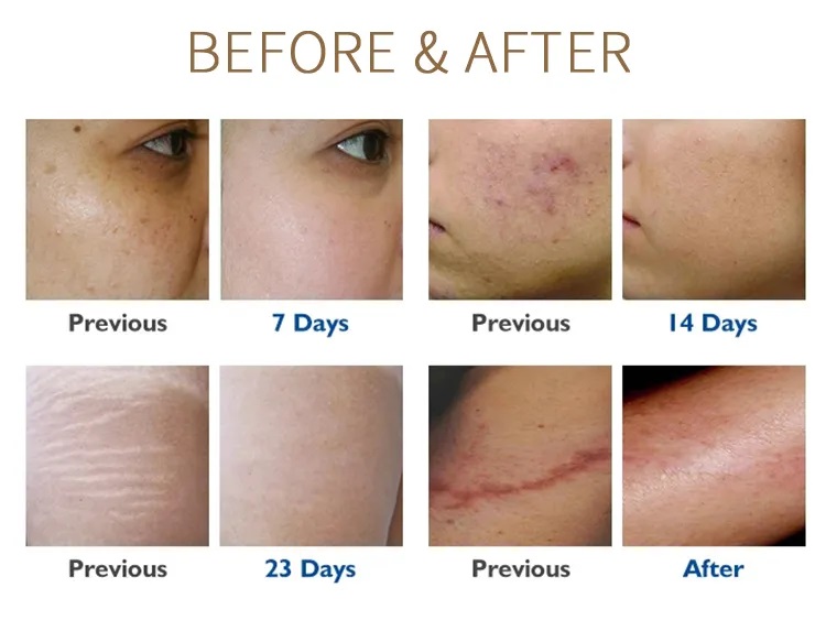 truoc-va-sau-dieu-tri.